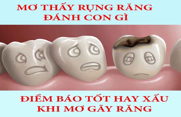 mơ rụng răng đánh con gì